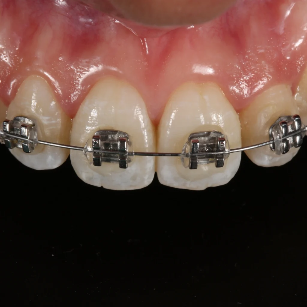 apparecchio dentale a milano porta romana