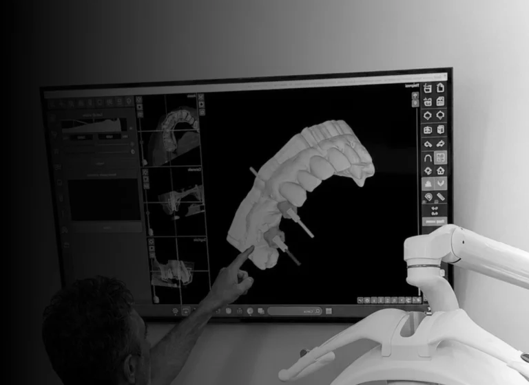 Impianti dentali a Milano Porta Romana